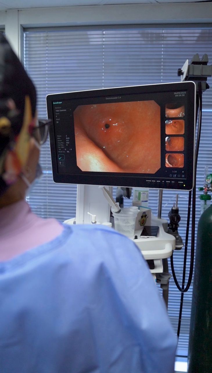 Monitor de endoscopia mostrando la mucosa del estómago durante el estudio