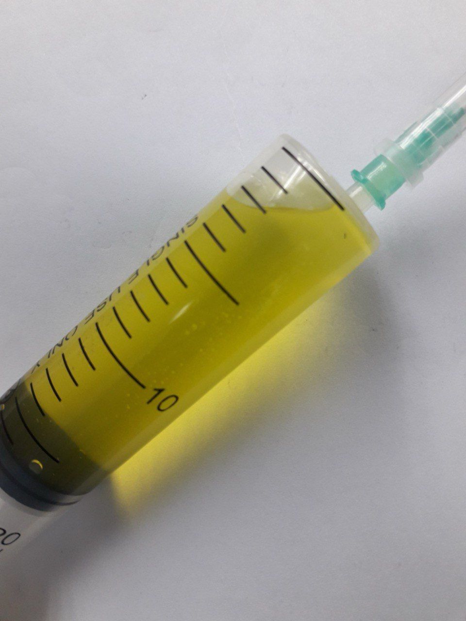 Jeringa con líquido ascítico de color amarillo obtenido por paracentesis